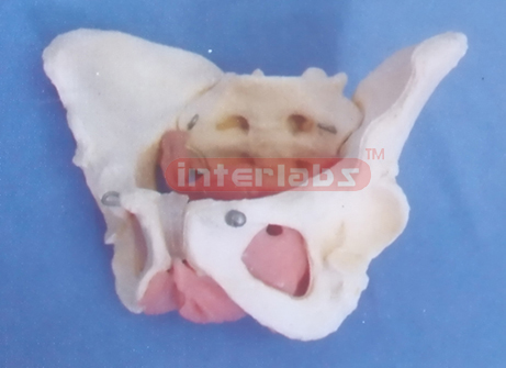 FEMALE MUSCULAR& INNER ORG  ENS IN PELVIS MODEL A TYPE